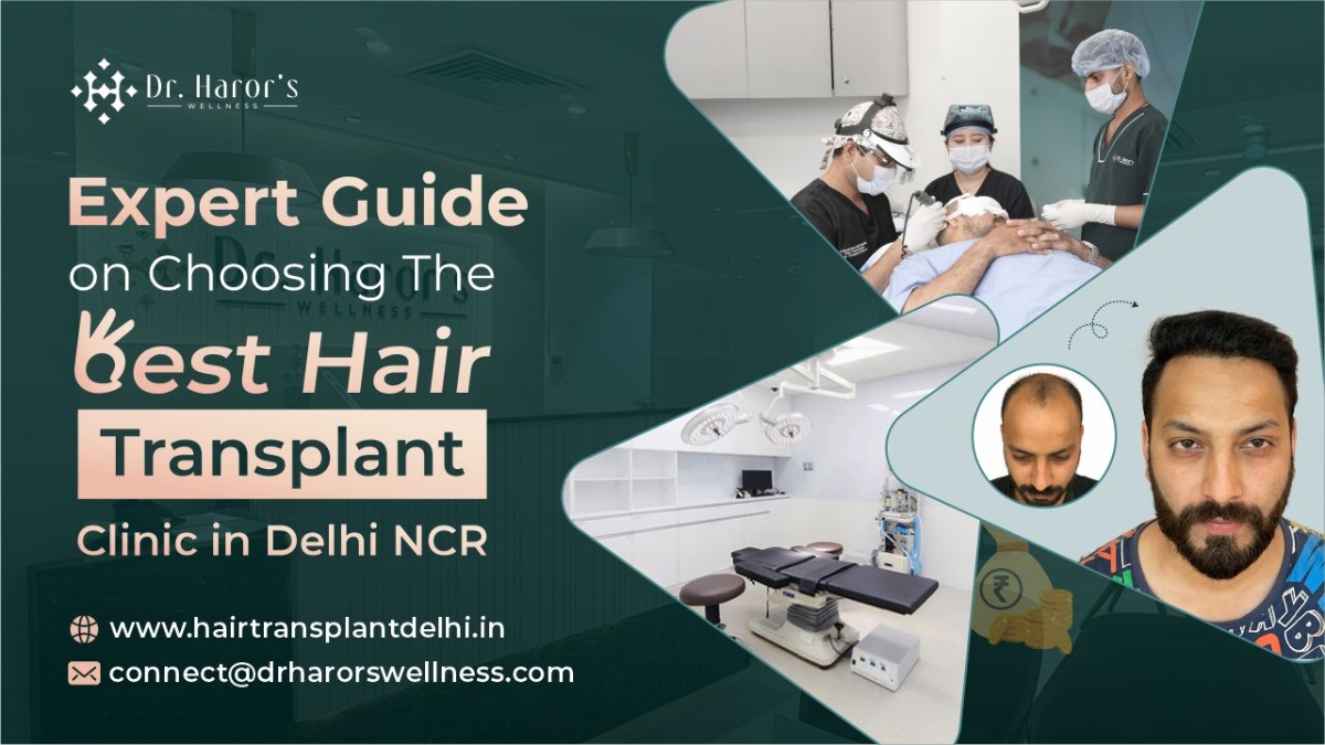 Expert Guide on Choosing the Best Hair Transplant Clinic in Delhi NCR